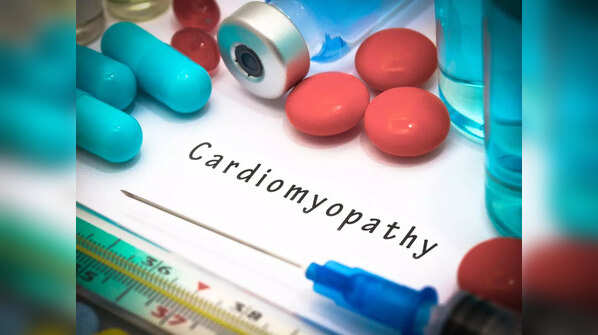 Takotsubo cardiomyopathy