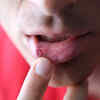 ​More about these new symptoms