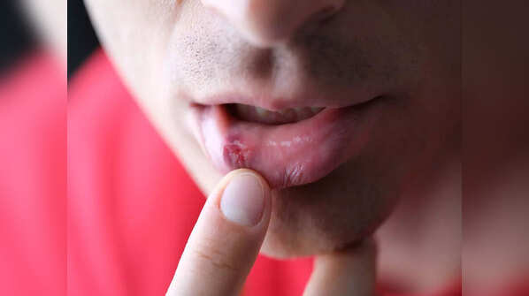 More about these new symptoms