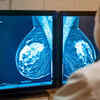 How to know for sure whether you have breast cancer