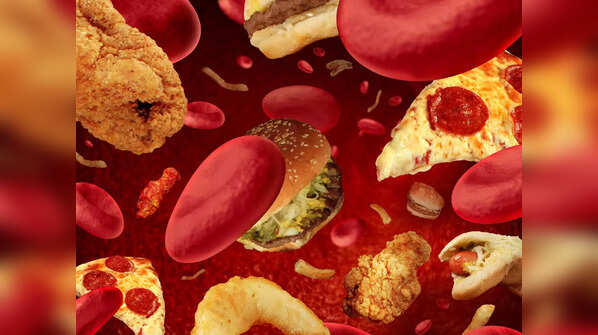 Factors that can increase your risk of high cholesterol