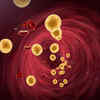 High cholesterol can cause other complications