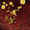 What happens when 'bad' cholesterol collects in the eyes
