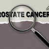 What younger men need to know about prostate cancer