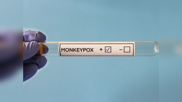 There is no vaccine for Monkeypox
