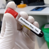 ​The monkeypox outbreak has spread from African countries