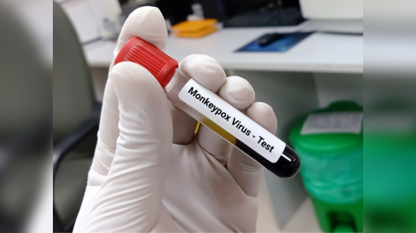 The monkeypox outbreak has spread from African countries