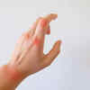 Joint inflammation, pain and stiffness