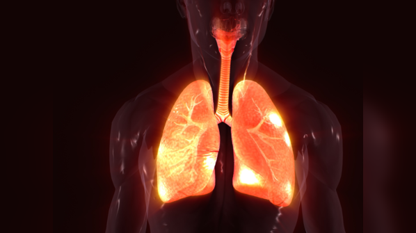 What causes lung cancer?