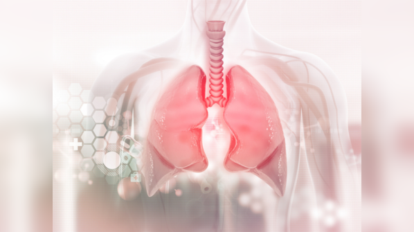 What is lung cancer?