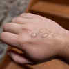 Know how long does a Monkeypox infection last