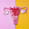 Endometriosis