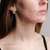 Excess vitamin B12 may cause harm too