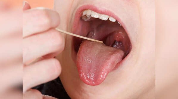Swollen tonsils