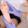 On treating lesions associated with monkeypox