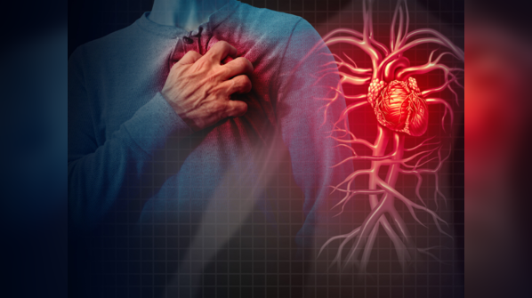Heart attack is dubbed as a silent killer