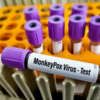 ​Current status of monkeypox
