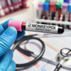 ​At which stage is the monkeypox infection highly contagious?