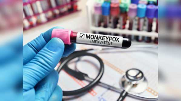 At which stage is the monkeypox infection highly contagious?
