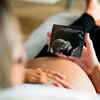 The first trimester (0-13 weeks)