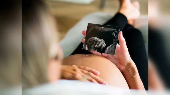 The first trimester (0-13 weeks)