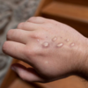 ​How the pet might have contracted the infection?