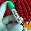 ​What happens in a cholesterol test