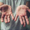 ​Monkeypox’s most telling symptom