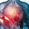 ​Types of cholesterol