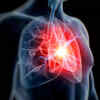Can you prevent a heart attack?