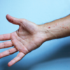​Monkeypox virus is not a novel one, but the way it spreads still surprises experts
