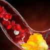 ​How to understand blood cholesterol report?