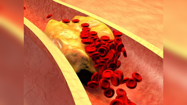 What is the ideal level of cholesterol, age wise?