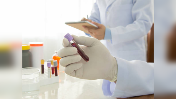 When should you start testing blood cholesterol level?