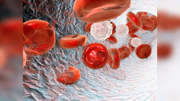 What to know about vitamin B12 deficiency anemia?