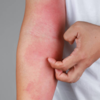 Article image for: How to take care of the skin during COVID