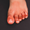 ​Different types of skin issues associated with COVID
