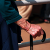 ​Walk can also be an indicator of dementia