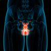 Article image for: <i class="tbold">prostate cancer</i> preventive measures