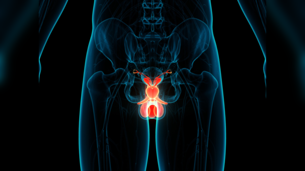 Prostate cancer preventive measures