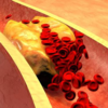 ​Risk factors