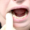 ​Loose teeth
