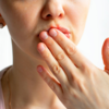 ​Sore that does not heal
