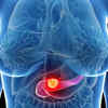 Can cancer spread?