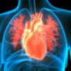 ​Nuclear cardiac stress test