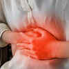 What severe illness looks like in COVID vs. dengue?