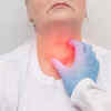 ​When to visit a doctor?
