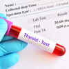 Article image for: What is <i class="tbold">hypothyroidism</i>?