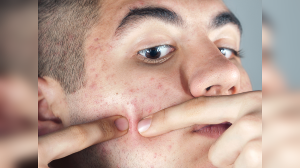 Pop pimples