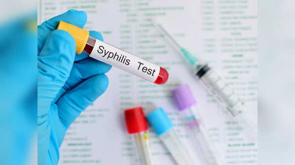 Syphilis